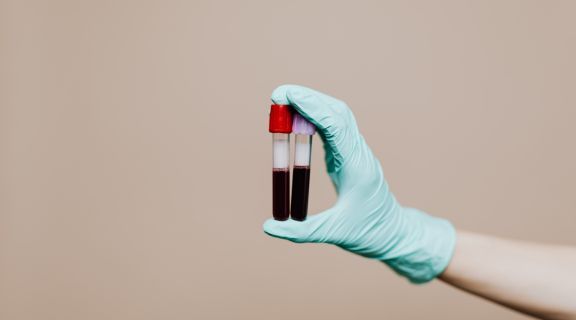 Quais são os exames hormonais femininos de rotina?