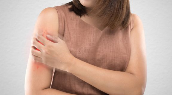 Quais são os principais sintomas da Dengue