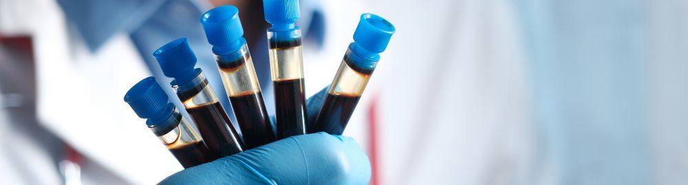 Semana 1 - corpo - Exames de sangue de rotina feminino1.jpg