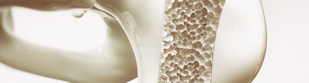 Tratamento de osteoporose1.jpg