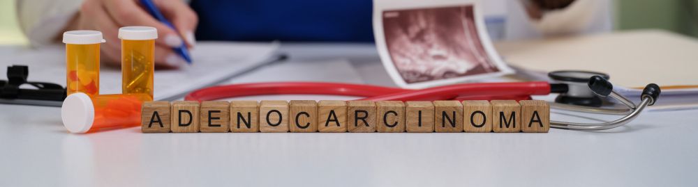 adenocarcinoma sintomas e tratamento1.jpg