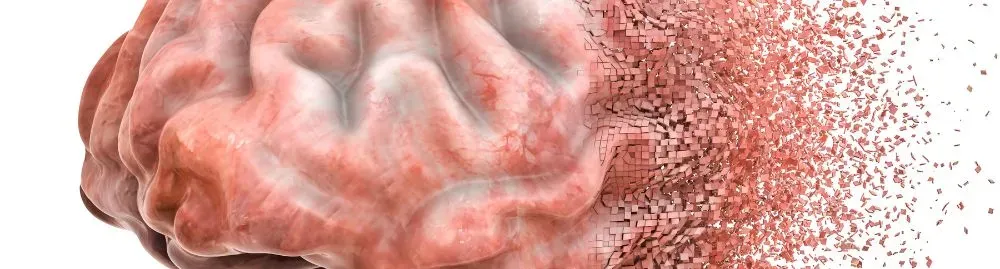 alzheimer é hereditário1.webp