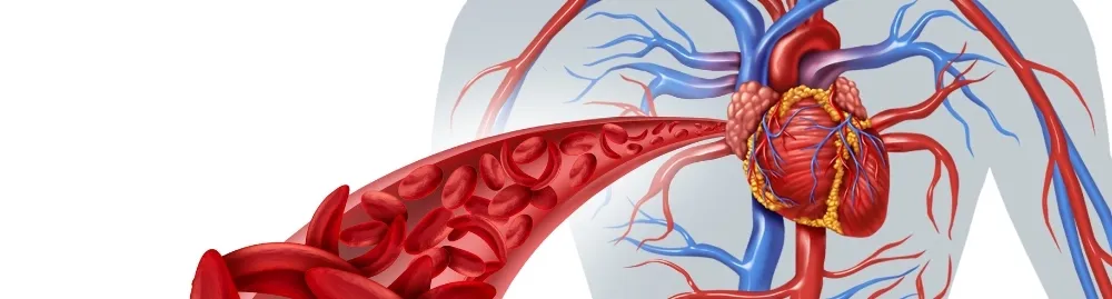 anemia falciforme é câncer1.webp