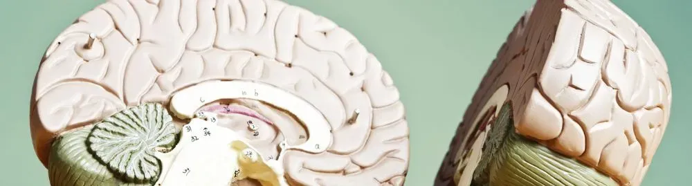 aneurisma cerebral sequelas1.webp