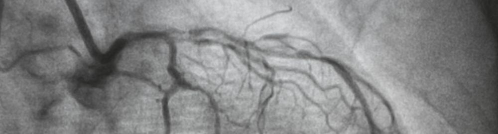 angiografia coronária_1.jpg