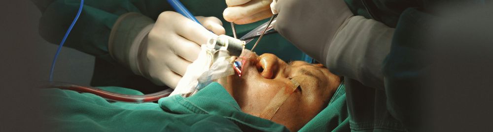apos cirurgia de catarata pode beber cerveja1.jpg