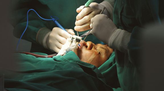 Após cirurgia de catarata pode beber cerveja? Saiba como é a recuperação