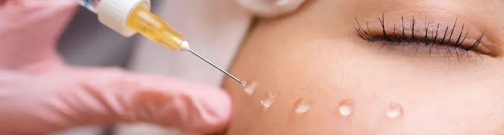 benefícios do bioestimulador de colágeno1.webp