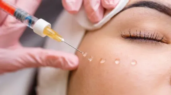 Benefícios do bioestimulador de colágeno: o que é e como rejuvenesce a pele