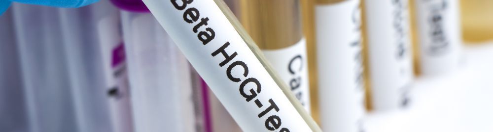 beta hcg 25 mui ml é de quantas semanas_1.jpg