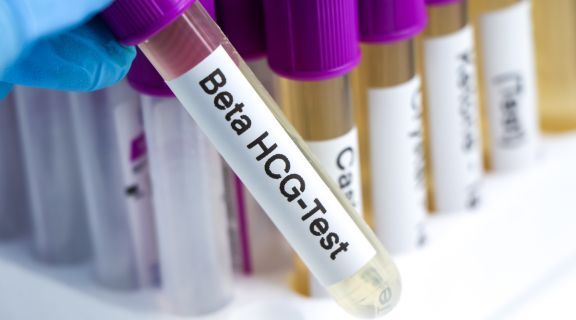 Beta hcg 25 mUI/mL é de quantas semanas: Como interpretar o resultado