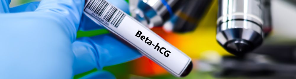 beta hcg precisa de pedido médico1.jpg