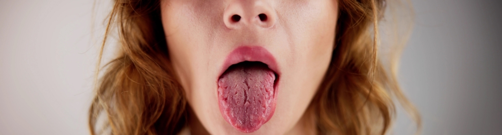câncer de boca relacionado ao hpv1.jpg