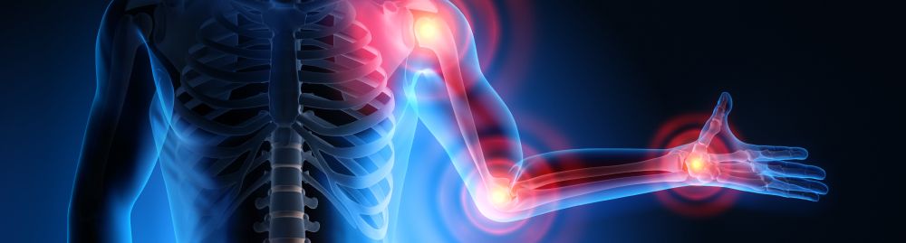 câncer de medula óssea sintomas1.jpg