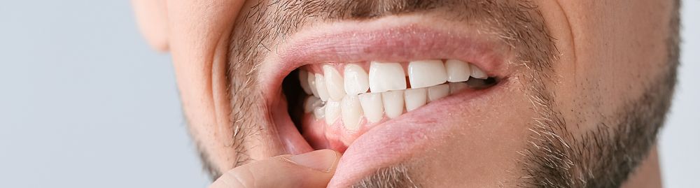 caroço na gengiva pode ser câncer1.jpg