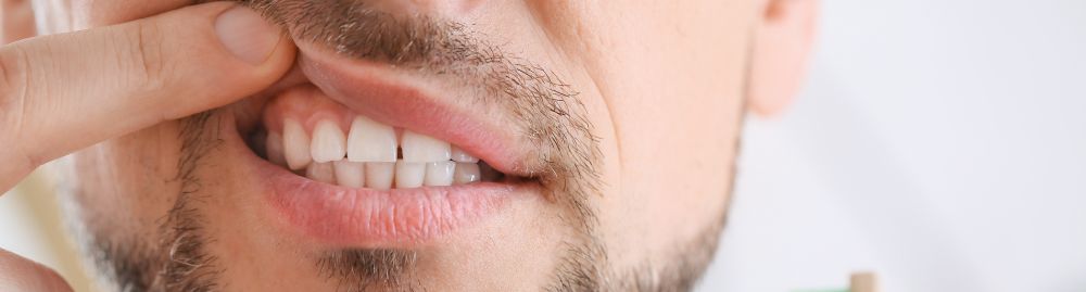 causas da gengivite_1.jpg