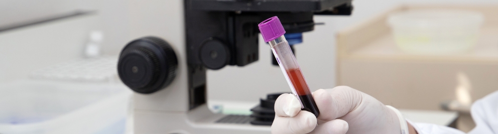 cirrose aparece no exame de sangue1.jpg