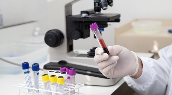 Cirrose aparece no exame de sangue? Veja o que pode acontecer no exame
