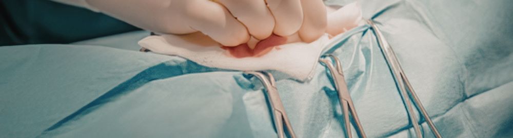 cirurgia para hiperidrose1.jpg