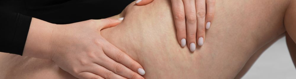 como acabar com a celulite das pernas_1.jpg