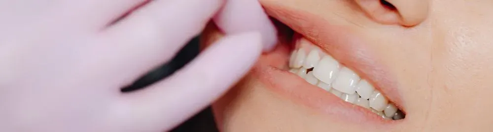 como desinflamar o dente1.webp