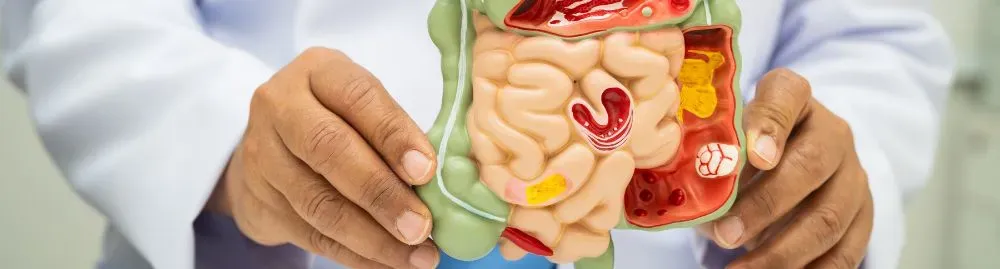 como desinflamar o intestino rapidamente1.webp