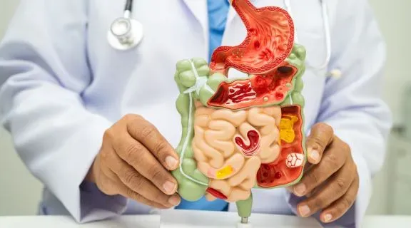 Como desinflamar o intestino rapidamente com métodos naturais