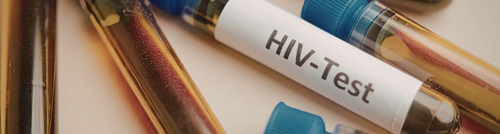 como se pega hiv1.jpg