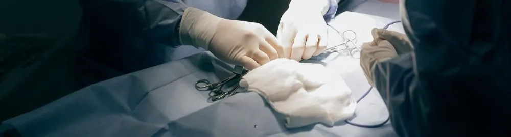 como tratar varicocele1.webp