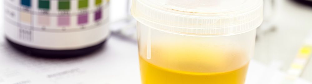 corpos cetônicos na urina_1.jpg