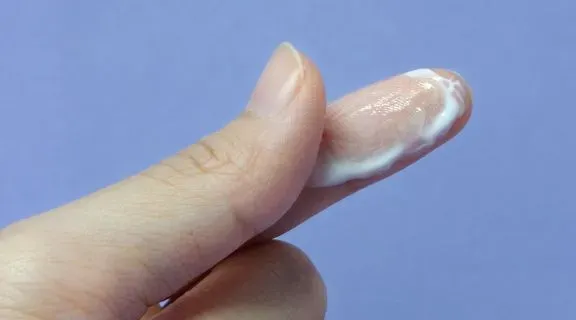 Corrimento tipo clara de ovo após laqueadura é normal ou o que significa?