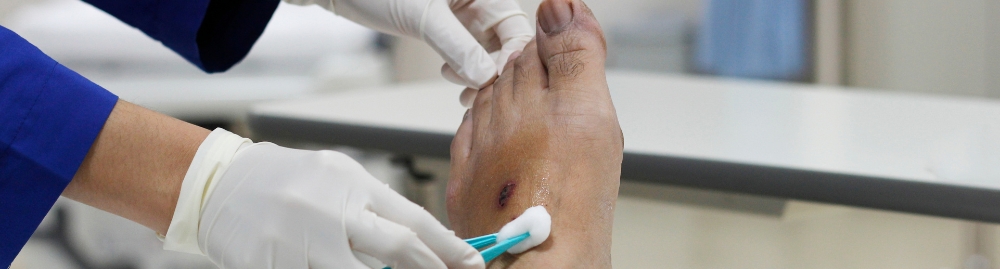 diabetes feridas que não cicatrizam_1.jpg