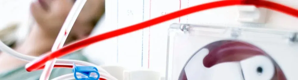 diálise e hemodiálise1.webp