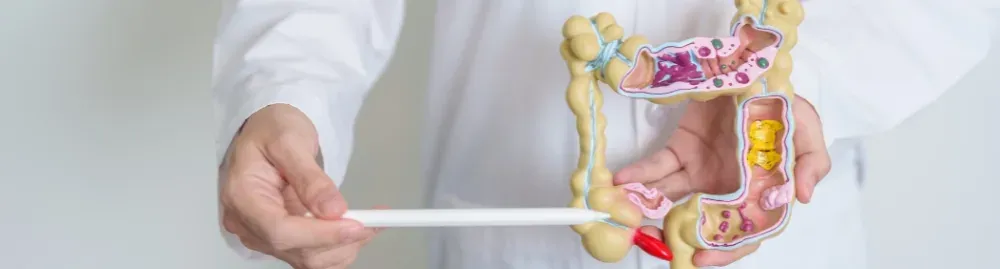 diverticulite intestinal​1.webp