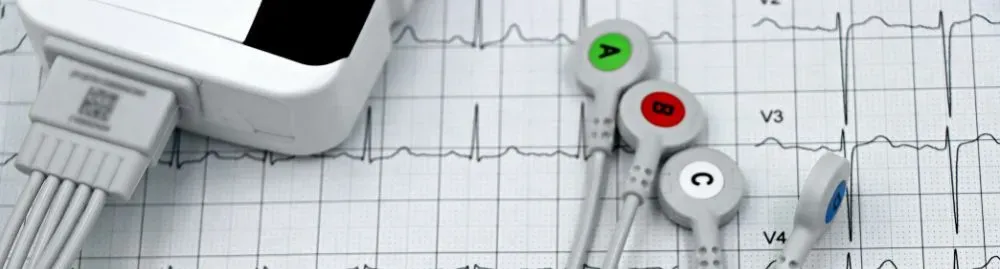 eletrocardiograma para que serve1.webp