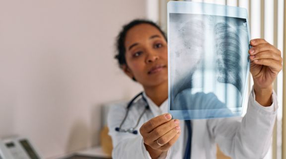 Especialistas em câncer de pulmão: saiba qual profissional de saúde procurar