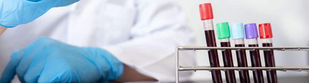 exame de sangue para hpv em homens1.jpg