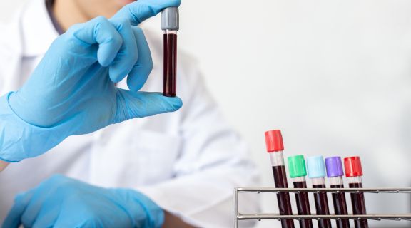   Exame de sangue para HPV em homens: por que ele não diagnostica a infecção?