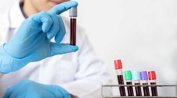 Exame de tireoide precisa de jejum? Entenda o preparo correto