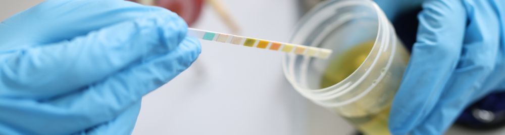 exame de urina detecta o que​1.jpg