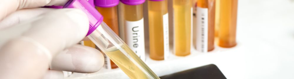 exame de urina para que serve​1.jpg