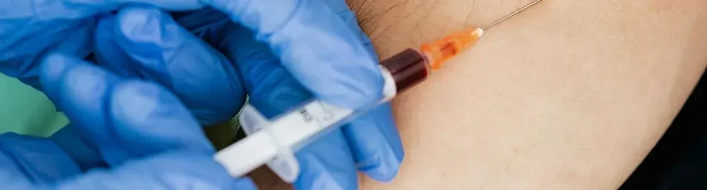 exame glicemia de jejum1.webp