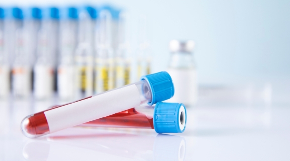 Exame de hemoglobina glicada precisa de jejum? Entenda como é o preparo
