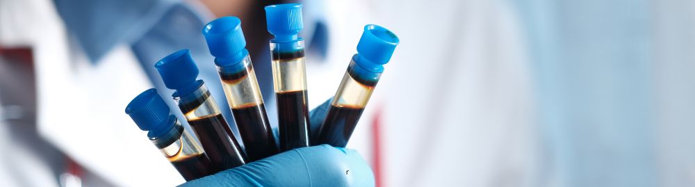 exames de sangue para criança​1.jpg
