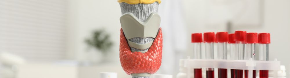 exames para hipotireoidismo​1.jpg