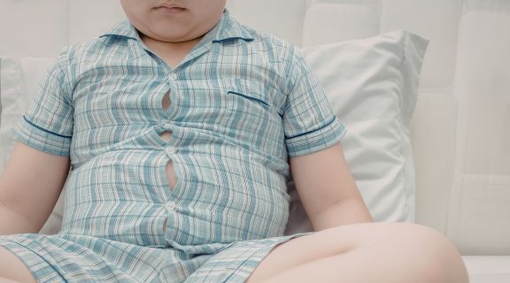 Obesidade infantil: fatores que causam o aumento de peso das crianças 