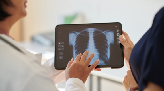 Fibrose pulmonar: o que é e como ela afeta a respiração e o pulmão