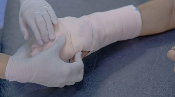 Fratura interna: primeiros socorros​ e o que fazer de maneira imediata