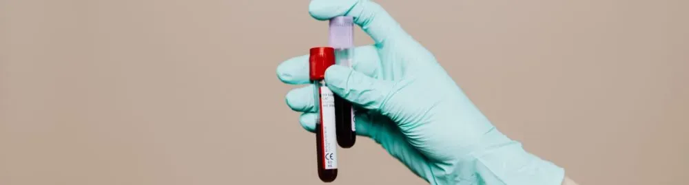 hba1c o que é1.webp