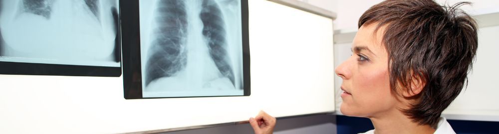 hipertensão pulmonar é grave​1.jpg